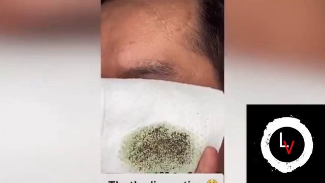 Green mask stick की अलसी सच्चाई #greenmaskstick #greenstickmask #greenmaskstickreview смотреть онлайн