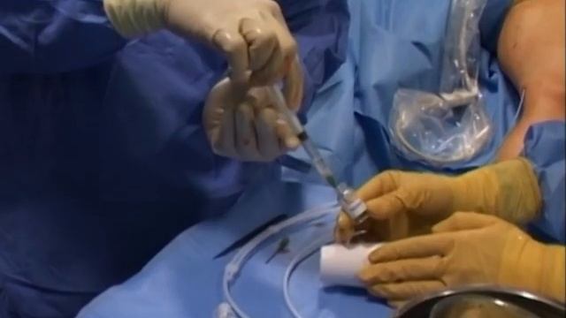 Латвия - пятое государство в мире, в котором при лечении вен используется биоклей смотреть онлайн