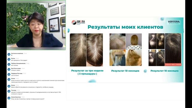 Как предотвратить выпадение волос и отрастить густые, длинные волосы смотреть онлайн