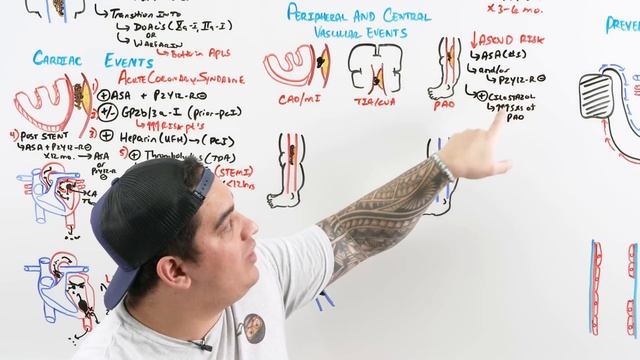 Antiplatelet, Anticoagulant, Thrombolytic Agents смотреть онлайн