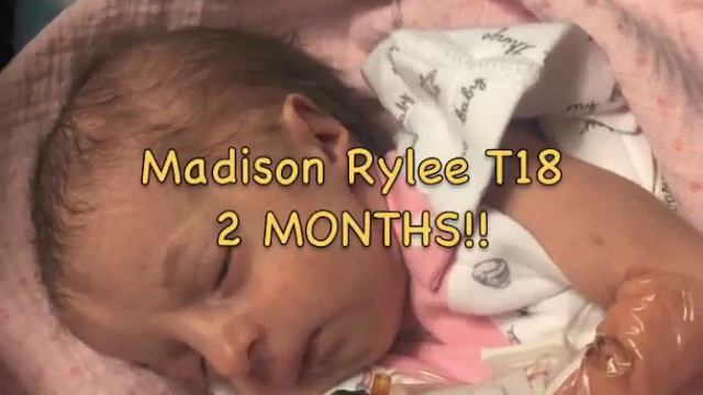 Trisomy 18 Awareness (He is With Us by Love and the Outcome) смотреть онлайн