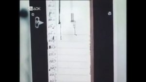 Лечебное голодание в СССР. Редкие кадры