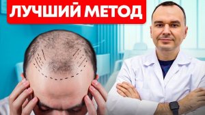 Пересадка волос. Какой метод выбрать: FUE или DHI | Александр Долгов