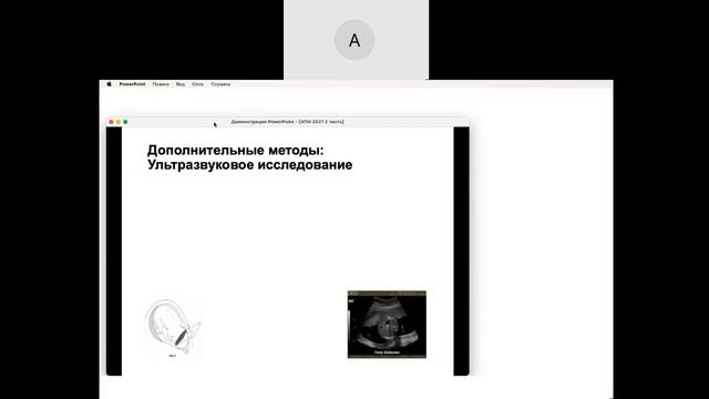 Хроническая плацентарная недостаточность