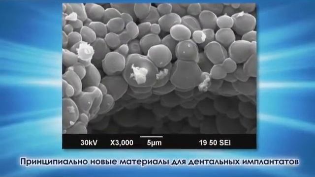 biokeramika смотреть онлайн