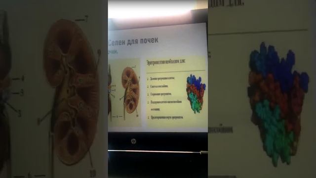 Эраконд и сироп Селен совместное использование 2 часть смотреть онлайн