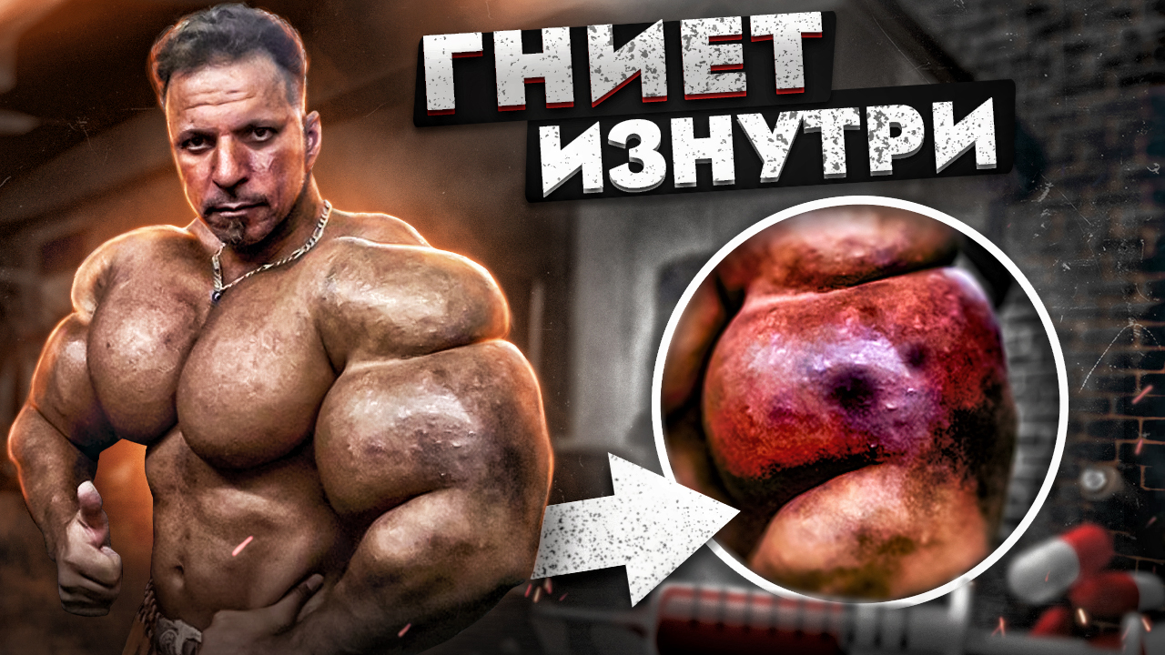 ПОЕХАВШИЕ ЖЕРТВЫ СИНТОЛА! ДИСМОРФИЯ У КАЧКОВ смотреть онлайн