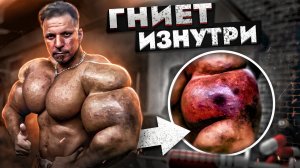 ПОЕХАВШИЕ ЖЕРТВЫ СИНТОЛА! ДИСМОРФИЯ У КАЧКОВ