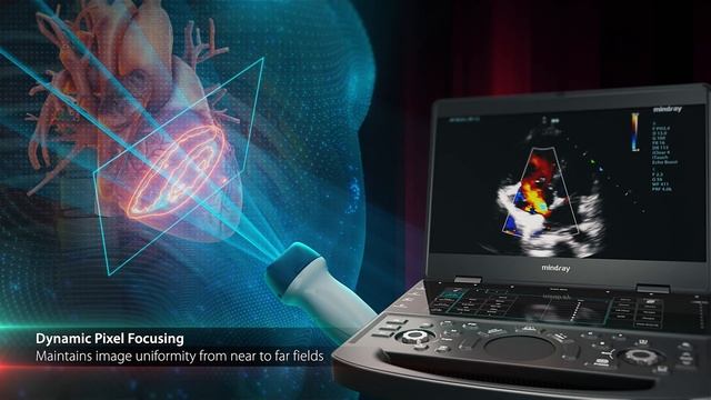 ME8 Ultrasound System - A dedicated point of care laptop смотреть онлайн