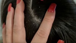 ASMR- Professional SCALP Cleansing?♀️ #microscope #scratching #dandruff #relaxing