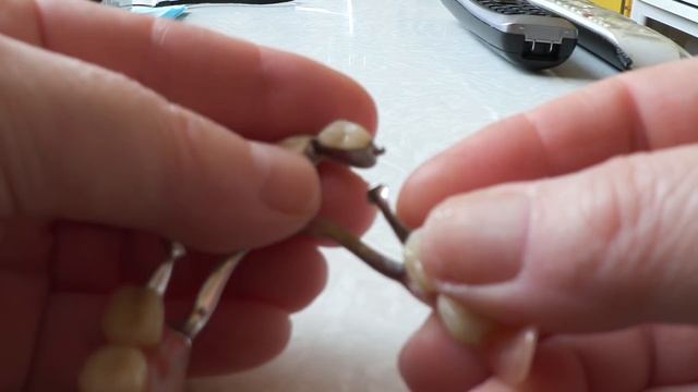 Бюгельный протез 11 лет / Моя зубная история / Опыт пациента / Часть 1 23 февраля 2019 г. смотреть онлайн