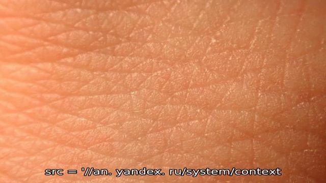 Симптомы и схема лечения грибка стопы у ребенка, профилактические меры смотреть онлайн