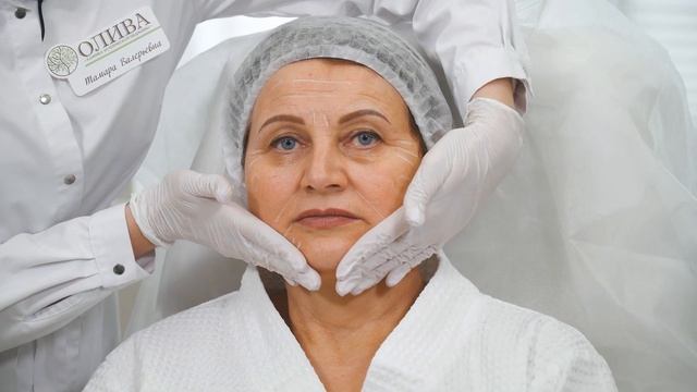 Лазерное омоложение на итальянском CO2 лазере DEKA. Лазерная шлифовка возрастной кожи. смотреть онлайн