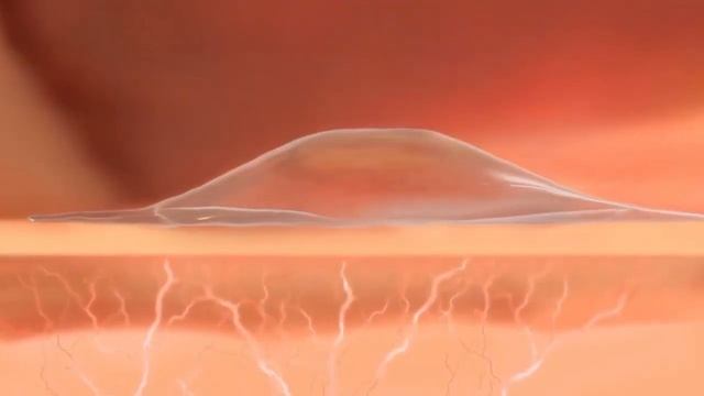 How Does Orasore Mouth Ulcer Gel Works. смотреть онлайн