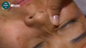 Скульптурно мануальный массаж лица. +Блефаропластический и интероральный.