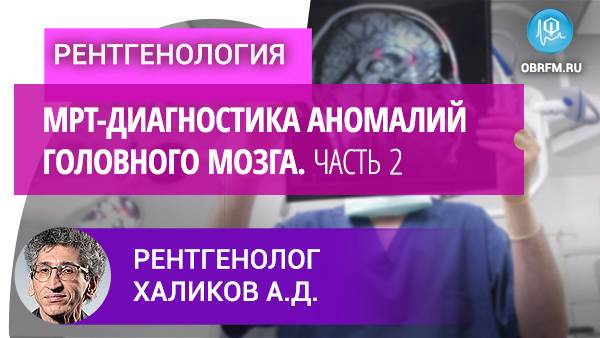 Рентгенолог Халиков А.Д.: МРТ-диагностика аномалий головного мозга. Часть 2 смотреть онлайн
