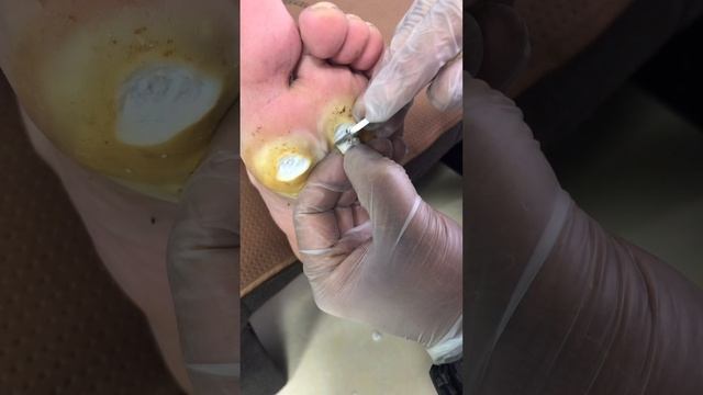 【Foot Scalpel】 смотреть онлайн