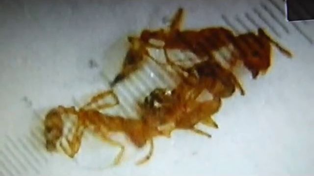 Подключение обычного фотоаппарата к телевизору и микроскопу МПБ-2 смотреть онлайн