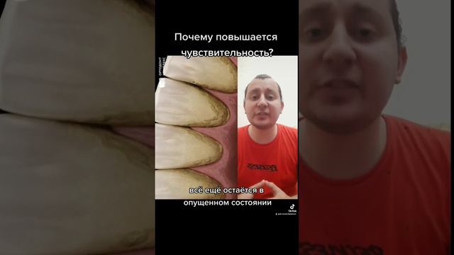 Почему повышается чувствительность после чистки? #чистказубов #гигиенаполостирта #зубнойкамень #зуб смотреть онлайн