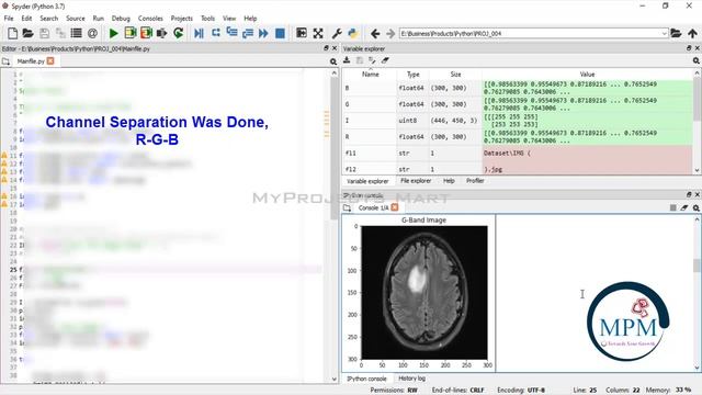 PYTHON 2021 Project - Brain Tumor Segmentation in MRI Images using Morphological and Thresholding смотреть онлайн
