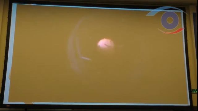 Шовная фиксация ИОЛ Эволюция методики смотреть онлайн