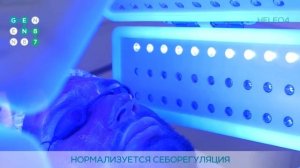 ФОТОДИНАМИЧЕСКАЯ ТЕРАПИЯ HELEO4™   Сеть клиник инновационной косметологии GEN87 в Москве