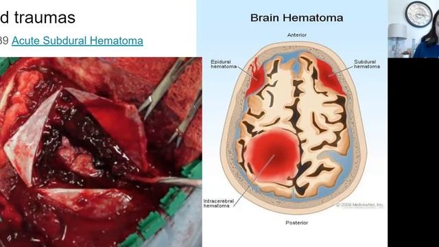 Neurosurgery Part 1