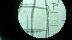 лейкоциты в камере Горяева