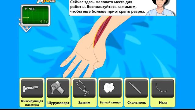 Ни чего себе упала|Operate now arm surgery смотреть онлайн