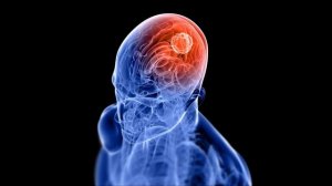 ✅ !!! ЗАБУДЬТЕ ВСЕ ЧТО ВЫ ЗНАЛИ ПРО  FOREX !!! ВСЯ ПРАВДА О FOREX !!! 1 ЧАСТЬ