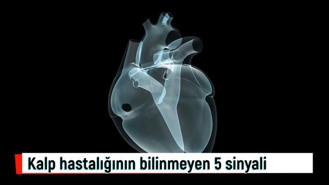 Kalp hastalığının bilinmeyen 5 sinyali! Bacak ağrısı, ödem, mide bulantısı deyip geçmeyin! смотреть онлайн