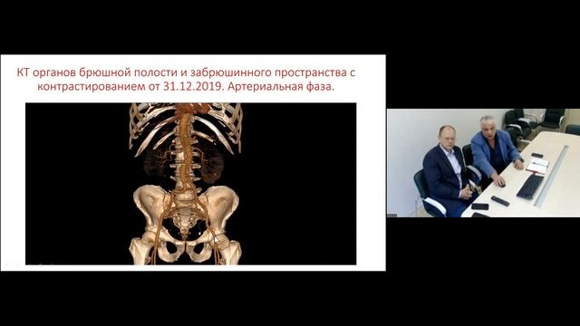 Дифференциальная диагностика юкставезикального уретеролитиаза и тазового флеболитиаза. смотреть онлайн