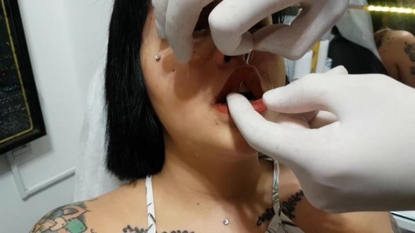 Dudak " Medusa " Piercing