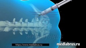Спинальная и эпидуральная анестезия: безопасные методы обезболивания