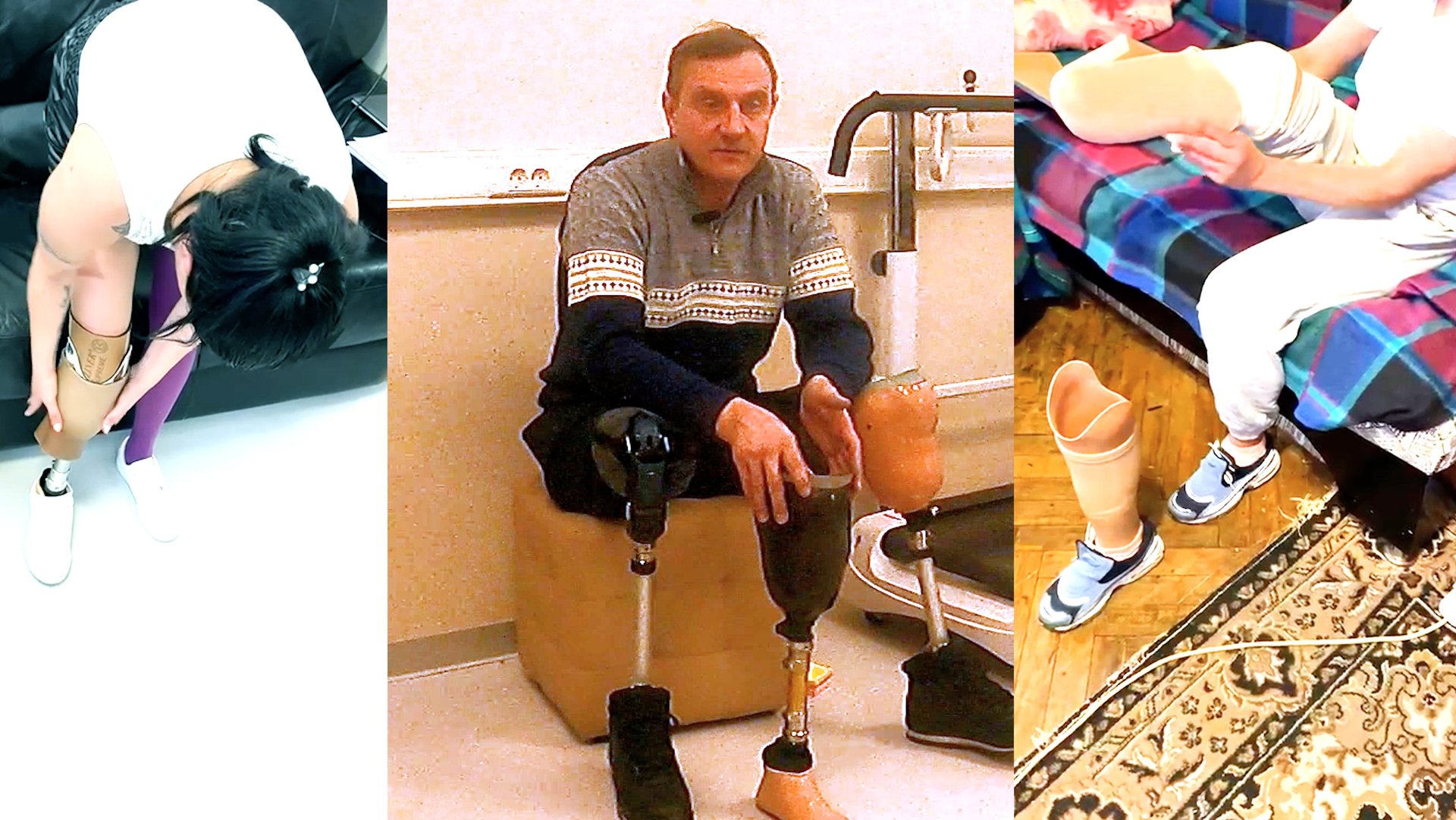 "Антарес Фит" - протезирование ног. Ответы на вопросы. смотреть онлайн