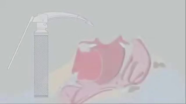 Ларингоскопы Heine смотреть онлайн