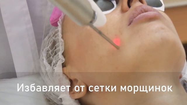 Fotona 4D - лазерное омоложение смотреть онлайн