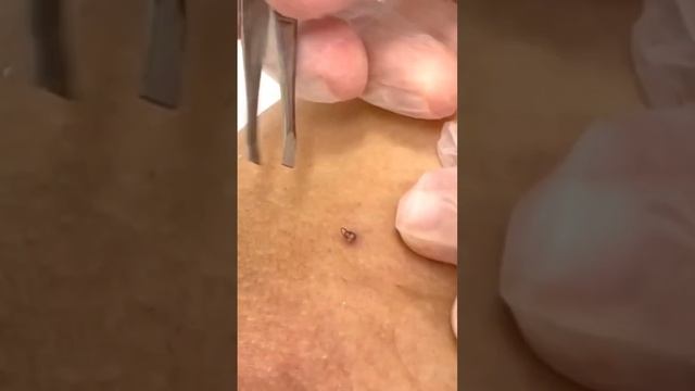 #лазернаяэпиляциябишкек #лазернаяэпиляция #гладкоебудущеереально #вросшиеволосы смотреть онлайн