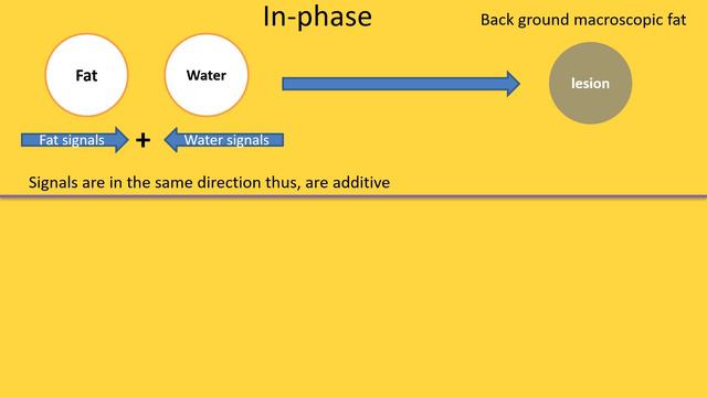 Adrenal MRI Technique
