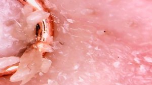 ЭТОТ ЛИЦЕВОЙ КЛЕЩ РЕАЛЬНО ЖИВЕТ НА ВАШЕМ ЛИЦЕ? (DEMODEX / КЛЕЩ ЖЕЛЕЗНИЦА)