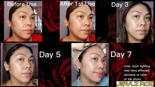L’Oreal Paris Revitalift Crystal Micro Essence Toner w Salicylic Acid and 1.5% Hyaluronic Acid Seru смотреть онлайн