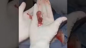 Живое ребёнок на руке после аборта