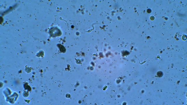 Tripanosoma Cruzi_Santa Barbara Honduras_Enero 2013