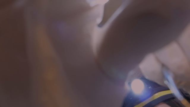 반보영 1인칭 치과 상황극 ASMR(안무서운 치석제거,후시녹음) | First Person Dentist Role Play ASMR(Removing plaques) Eng sub смотреть онлайн