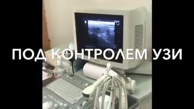 Гасанова Атия Арсланалиевна. Врач-УЗИ смотреть онлайн