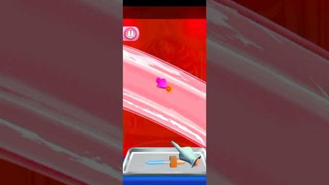 Open heart surgery new game - Doctor game. смотреть онлайн
