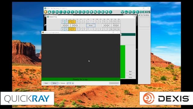 Tutorial- How to Use QuickRayConnect TWAIN in Dexis 10 and up смотреть онлайн