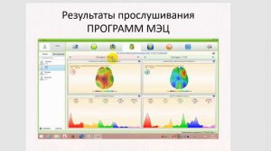 Брэйфбизнес. МОО ЕДИНСТВО. Что такое ПРОГРАММЫ МЭЦ?