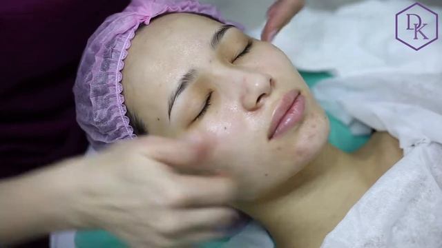 Победительница конкурса 7 этапная чистка лица + Алмазной микродермабразия 1 часть смотреть онлайн