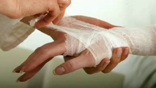 При Ожогах Народное средство смотреть онлайн